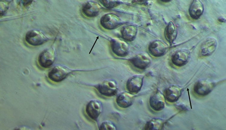 Анаэробный микроорганизм живет в лососевых